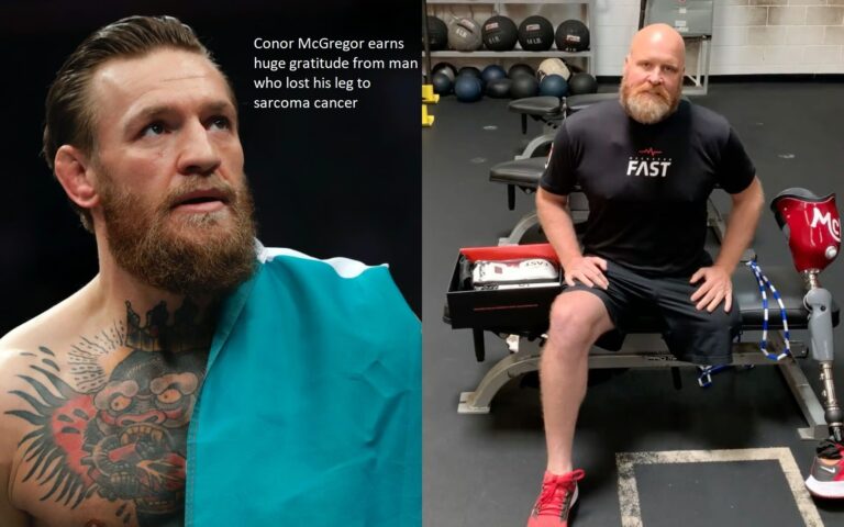 Conor McGregor earns huge gratitude from man who lost his leg to sarcoma cancer 