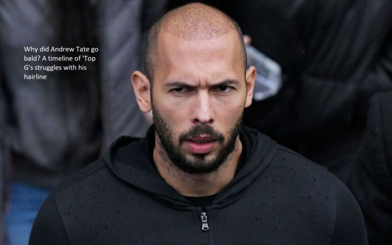 Why did Andrew Tate go bald? A timeline of ‘Top G’s struggles with his hairline
